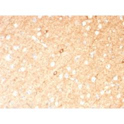 GAD1 / GAD67 (GABAergic Neuronal Marker) (GAD1/2391), CF640R conjugate, 0.1mg/mL