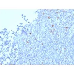 Granzyme B (NK/T-Cell Lymphoma Marker) (GZMB/2403), CF640R conjugate, 0.1mg/mL