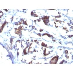 ZFYVE28 (Zinc Finger FYVE-type containing 28)(LST2/2426), CF640R conjugate, 0.1mg/mL