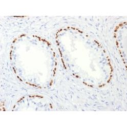 p63 (Squamous, Basal & Myoepithelial Cell Marker) (TP63/2427), CF640R conjugate, 0.1mg/mL