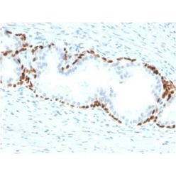 p63 (Squamous, Basal & Myoepithelial Cell Marker) (TP63/2428), CF640R conjugate, 0.1mg/mL