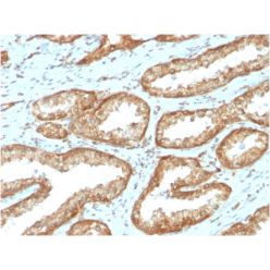 YBX1 / Y-box Binding Protein 1 / YB-1 (Tumor Biomarker)(YBX1/2430), CF640R conjugate, 0.1mg/mL