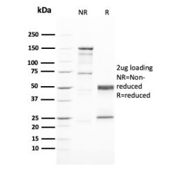 GATA-3 (Breast and Urothelial Marker)(GATA3/2446), CF640R conjugate, 0.1mg/mL