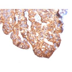 HER-2 / c-erbB-2 / neu / CD340 (ERBB2/2452), CF640R conjugate, 0.1mg/mL