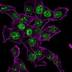 Ki-67 (Proliferating Cell Marker) (MKI67/2465), CF640R conjugate, 0.1mg/mL