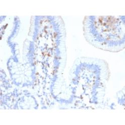 Biotium BNC402474-500, CD103 / Integrin alpha E (T-Cell Lymphoma & Hairy Cell Leukemia Marker) (ITGAE/2474), CF640R conjugate, 0.1mg/mL