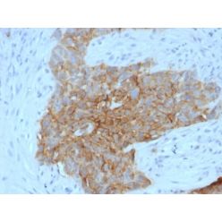 GLUT-1 (Tumor Progression and Mesothelioma Marker) (GLUT1/2475), CF640R conjugate, 0.1mg/mL