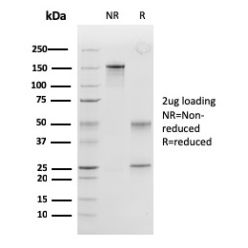 Peroxiredoxin 4 (Prognostic Marker for Lung SqCC)(CPTC-PRDX4-2), CF640R conjugate, 0.1mg/mL