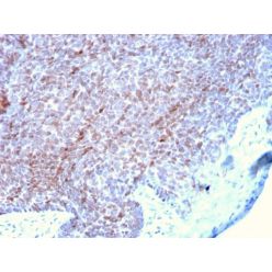 p73 (Tumor Suppressor)(P73/2531), CF640R conjugate, 0.1mg/mL