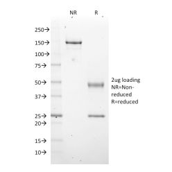 EZH2 / KMT6(EZH2/2536), CF640R conjugate, 0.1mg/mL