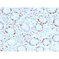 SOX4 (Master Regulator of Epithelial-Mesenchymal Transition) (SOX4/2540), CF640R conjugate, 0.1mg/mL