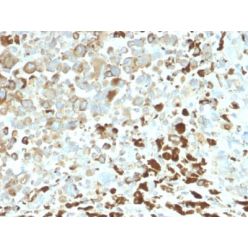 NGF-Receptor (p75) / CD271 (Soft Tissue Tumor Marker) (NGFR/2550R), CF640R conjugate, 0.1mg/mL