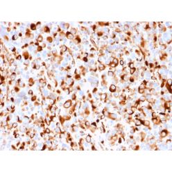 NGF-Receptor (p75) / CD271 (Soft Tissue Tumor Marker)(rNGFR/1965), CF640R conjugate, 0.1mg/mL