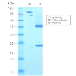 Human IgM (Immunoglobulin Mu Heavy Chain) (B-Cell Marker)(rIGHM/2558), CF640R conjugate, 0.1mg/mL