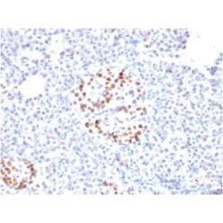 NKX6.1 (Marker for Pancreatic and Duodenal Neuroendocrine Tumors) (NKX61/2561), CF640R conjugate, 0.1mg/mL
