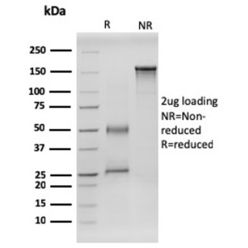 RET Proto-oncogene(RET/2599), CF640R conjugate, 0.1mg/mL
