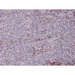 MSH2 (DNA Mismatch Repair Marker)(MSH2/2622), CF640R conjugate, 0.1mg/mL