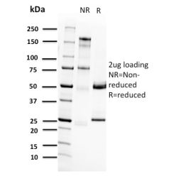 RET Proto-oncogene(RET/2662), CF640R conjugate, 0.1mg/mL