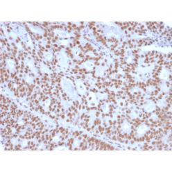 Progesterone Receptor (Marker of Progestin Dependence)(PGR/2694), CF640R conjugate, 0.1mg/mL