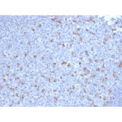 PDCD1 / PD1 / CD279 (Programmed Cell Death 1)(PDCD1/2720), CF640R conjugate, 0.1mg/mL