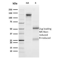 n-Myc (Neuroblastoma Marker)(NMYC-1), CF640R conjugate, 0.1mg/mL