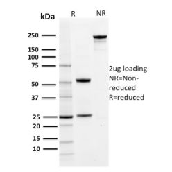 PD-L1 / PDCD1LG1 / CD274 / B7-H1 (Cancer Immunotherapy Target)(PDL1/2742), CF640R conjugate, 0.1mg/mL