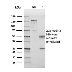 PD-L1 / PDCD1LG1 / CD274 / B7-H1 (Cancer Immunotherapy Target)(PDL1/2745), CF640R conjugate, 0.1mg/mL
