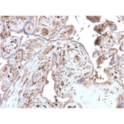 S100A4 (Marker of Tumor Metastasis) (S100A4/2750R), CF640R conjugate, 0.1mg/mL