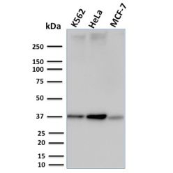 RAD51 (Prognostic and Response to Chemotherapy Marker)(RAD51/2753), CF640R conjugate, 0.1mg/mL