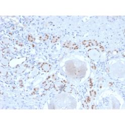 PAX8 (Renal Cell Marker)(PAX8/2774R), CF640R conjugate, 0.1mg/mL