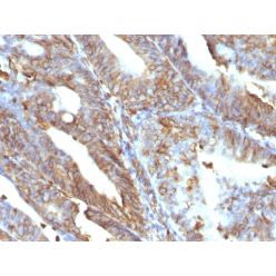 Vimentin (Mesenchymal Cell Marker)(V9), CF640R conjugate, 0.1mg/mL