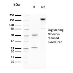Desmoglein-3 (Squamous Cell Marker)(DSG3/2796), CF640R conjugate, 0.1mg/mL