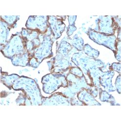 MMP3 (Marker of Metastasis and Rheumatoid Arthritis)(MMP3/2806), CF640R conjugate, 0.1mg/mL