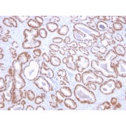 NKX3.1 (Metastatic Prostate Adenocarcinoma Marker)(NKX3.1/2836), CF640R conjugate, 0.1mg/mL