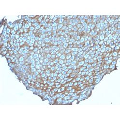 Desmoglein-3 (Squamous Cell Marker)(DSG3/2838), CF640R conjugate, 0.1mg/mL