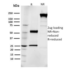 EGFR (Epidermal Growth Factor Receptor)(R1), CF640R conjugate, 0.1mg/mL