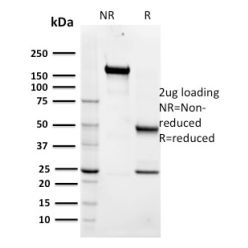 Maltose Binding Protein / MBP-probe(R29.6), CF640R conjugate, 0.1mg/mL
