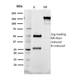Tal1(BTL73), CF640R conjugate, 0.1mg/mL