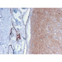 Drebrin 1 (DBN1)(DBN1/2879), CF640R conjugate, 0.1mg/mL