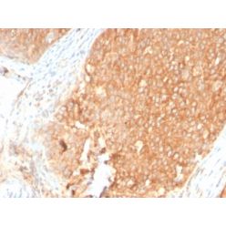 Topoisomerase I, Mitochondrial (TOP1MT) (TOP1MT/2883R), CF640R conjugate, 0.1mg/mL