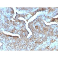 Thymidine Phosphorylase / PD-ECGF (Angiogenesis Marker) (TYMP/2890R), CF640R conjugate, 0.1mg/mL