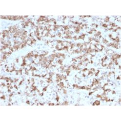 Prolactin (Pituitary Tumor Marker)(PRL/2910), CF640R conjugate, 0.1mg/mL