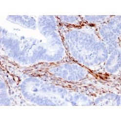 Nestin (Cancer Stem Cell Marker)(NES/2911), CF640R conjugate, 0.1mg/mL