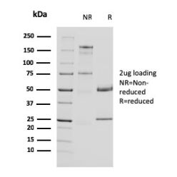 Uroplakin 1A (Urothelial Differentiation Marker)(UPK1A/2924), CF640R conjugate, 0.1mg/mL
