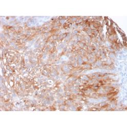 Uroplakin 1A (Urothelial Differentiation Marker)(UPK1A/2925), CF640R conjugate, 0.1mg/mL