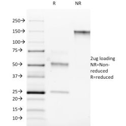 ROR-gamma / RORC (RAR-related Orphan Receptor C)(RORC/2942), CF640R conjugate, 0.1mg/mL