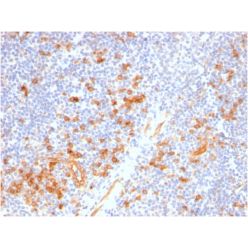 IL3RA / CD123 (Acute Myeloid Leukemia Marker)(IL3RA/2947R), CF640R conjugate, 0.1mg/mL