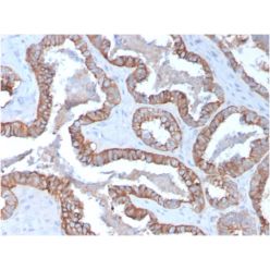 Cytokeratin 15 (Esophageal Squamous Cell Carcinoma Marker)(KRT15/2957), CF640R conjugate, 0.1mg/mL
