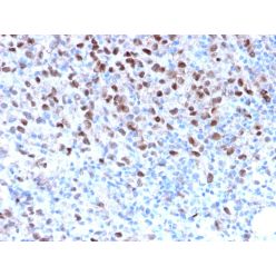 Microphthalmia Transcription Factor (MITF)(MITF/2987R), CF640R conjugate, 0.1mg/mL