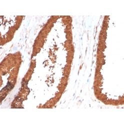 TIGIT / VSTM3 / VSIG9 (Immune Checkpoint for Cancer)(TIGIT/3017), CF640R conjugate, 0.1mg/mL